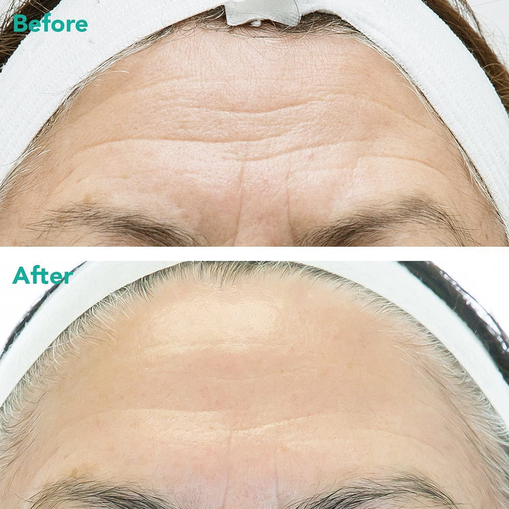 ® Advanced Anti-Aging Retinol + C-Pdrn® Serum - Boosting Facial Serum for Firmness, Radiance and Anti-Wrinkle Care, Clinically Developed (1.01 Fl Oz)